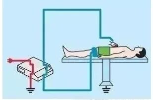 为什么手术用电刀手术室高频电刀那些事，看这篇就够了！_https://www.jmylbn.com_新闻资讯_第8张