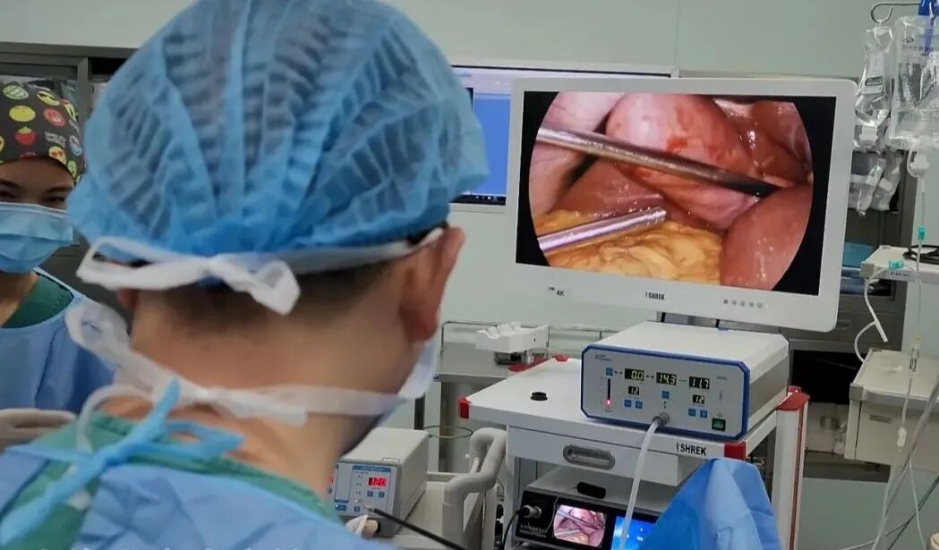 吻合器怎么使用方法医加百科 ｜ 使用吻合器的注意事项及常见问题_https://www.jmylbn.com_新闻资讯_第5张