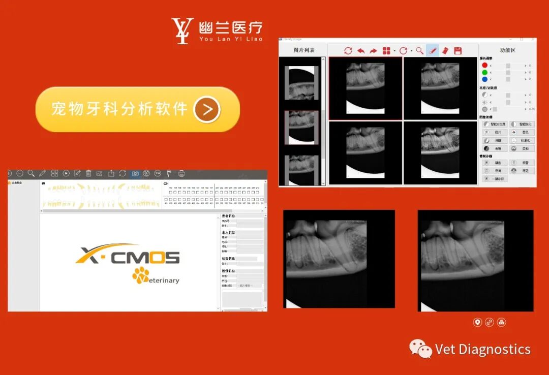 口腔 DR机器怎么用牙科X光（DR／CR）的重要性_https://www.jmylbn.com_新闻资讯_第6张