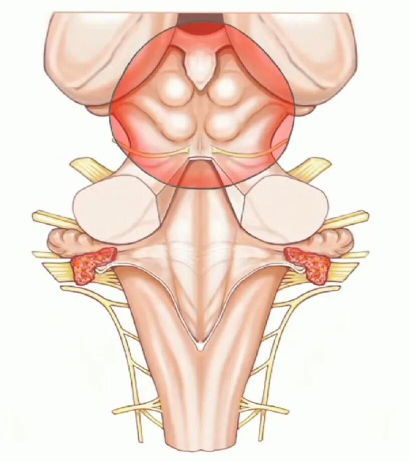 外展枕怎么使用脑干解剖及相关入路---Rhoton解剖视频学习笔记系列_https://www.jmylbn.com_新闻资讯_第210张