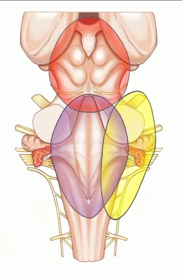外展枕怎么使用脑干解剖及相关入路---Rhoton解剖视频学习笔记系列_https://www.jmylbn.com_新闻资讯_第160张