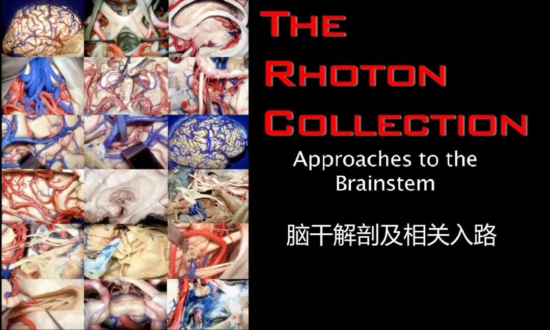 外展枕怎么使用脑干解剖及相关入路---Rhoton解剖视频学习笔记系列_https://www.jmylbn.com_新闻资讯_第1张