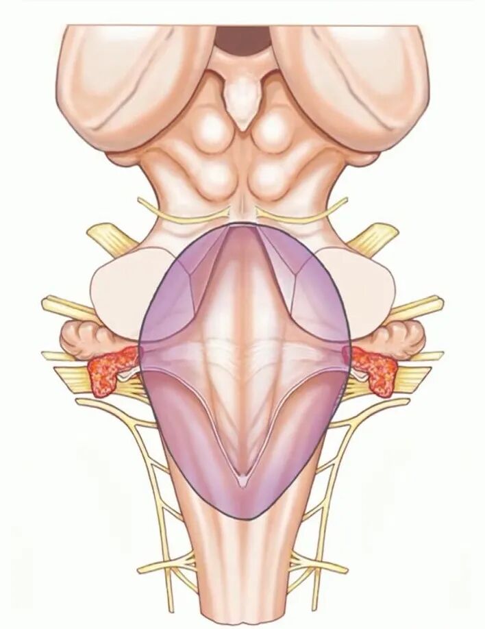 外展枕怎么使用脑干解剖及相关入路---Rhoton解剖视频学习笔记系列_https://www.jmylbn.com_新闻资讯_第106张