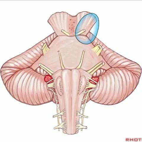 外展枕怎么使用脑干解剖及相关入路---Rhoton解剖视频学习笔记系列_https://www.jmylbn.com_新闻资讯_第41张