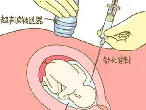 无创建议做几项指标的_无创建议做贵的还是便宜的_不建议做无创plus