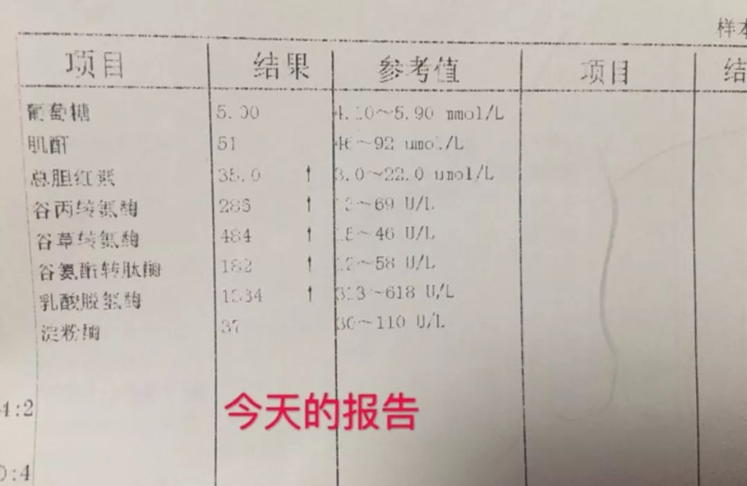 【病例咨詢精選】反覆上腹劇痛、肝功能異常是什麼原因？ 健康 第4張