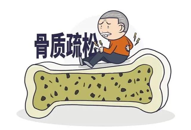 老年人的"致命威胁"——髋部骨折 - 基层网