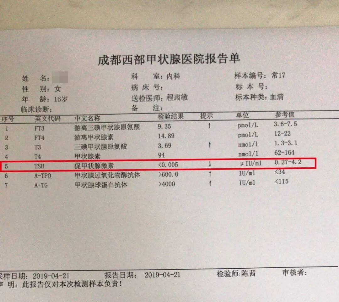 甲亢脖子和正常脖子图片_甲亢患者的脖子图片_甲亢大脖子图片