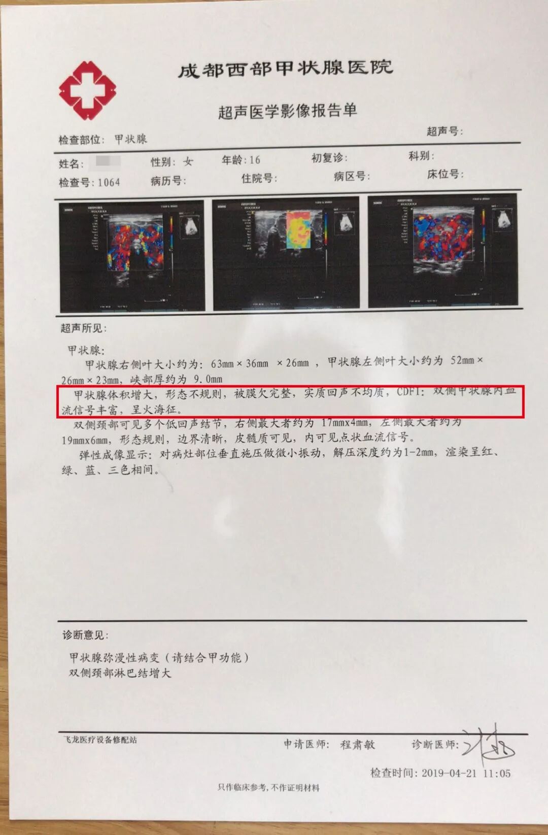 甲亢大脖子图片_甲亢脖子和正常脖子图片_甲亢患者的脖子图片