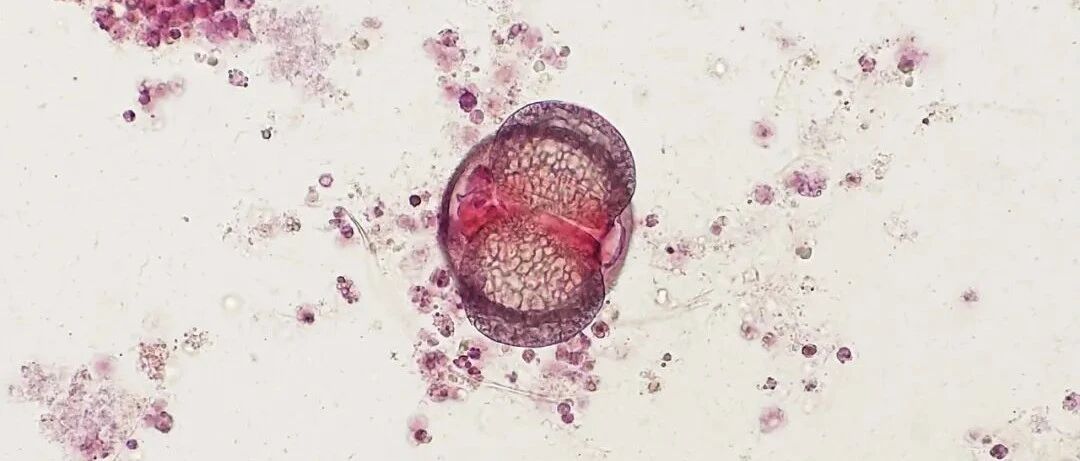 形态学神探、镜下福尔摩斯……一起走进这位检验人的世界