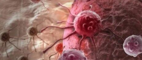 普通体检能查出癌症吗？医学博士坦言：发现早癌很难！