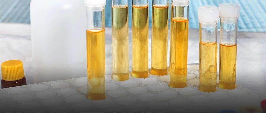 色素管型，那些重 “色” 的管型都是什么？