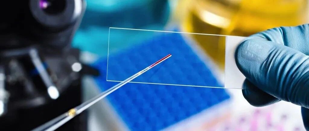 区域检验中心，未来检验科发展的方向？