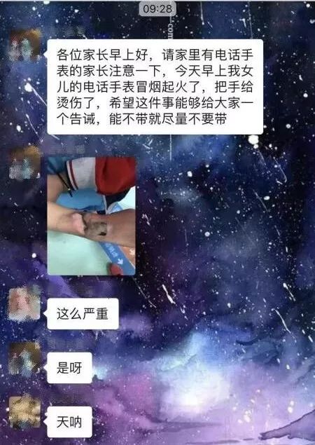 小孩戴的手表电话_专家不建议小孩戴电话手表_小孩戴手表电话对身体有害吗