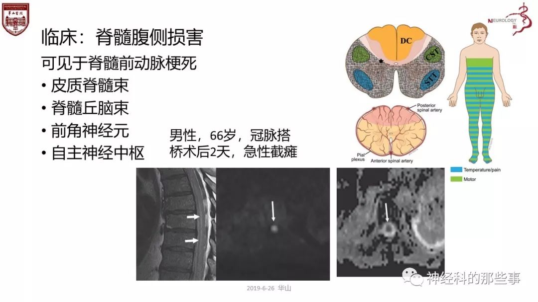 脊髓的解剖和定位诊断