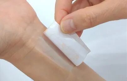 创面修复抗菌敷料怎么用【创面修复频道】伤口处理的基本原则。（聂邯洛医师推荐）_https://www.jmylbn.com_新闻资讯_第57张