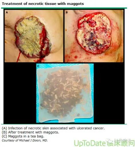 创面修复抗菌敷料怎么用【创面修复频道】伤口处理的基本原则。（聂邯洛医师推荐）_https://www.jmylbn.com_新闻资讯_第21张