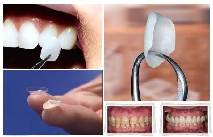 口腔无痛麻醉仪怎么用优质学科速览——第924医院口腔科_https://www.jmylbn.com_新闻资讯_第8张