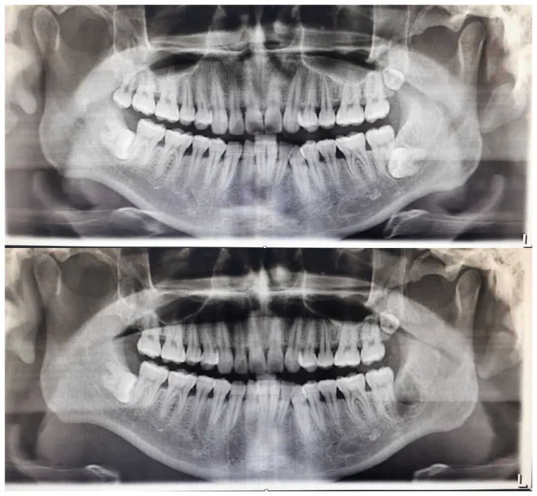 口腔无痛麻醉仪怎么用优质学科速览——第924医院口腔科_https://www.jmylbn.com_新闻资讯_第13张