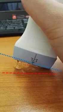什么是超声容积探头血流量测定 ｜取样容积和角度θ_https://www.jmylbn.com_新闻资讯_第9张