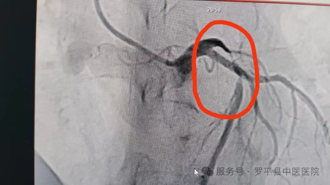 是什么原因一走路就喘呢