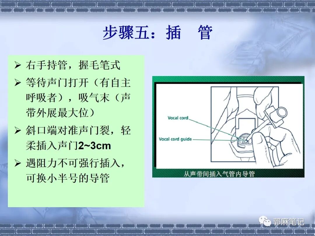 喉镜怎么选型号关于小儿气管插管术及并发症处理_https://www.jmylbn.com_新闻资讯_第21张