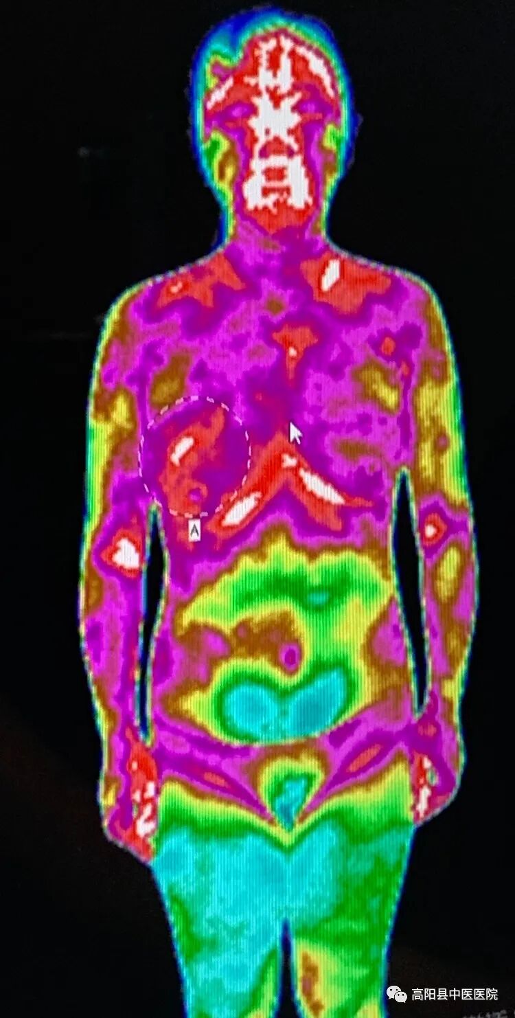 医用红外热像仪怎么开机【特色技术】我院引进红外热像仪，“一眼看穿”你的健康状况！_https://www.jmylbn.com_新闻资讯_第7张