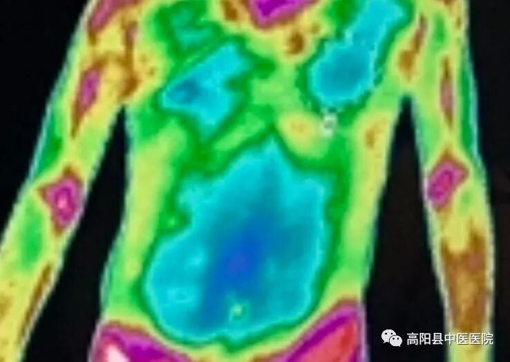 医用红外热像仪怎么开机【特色技术】我院引进红外热像仪，“一眼看穿”你的健康状况！_https://www.jmylbn.com_新闻资讯_第6张