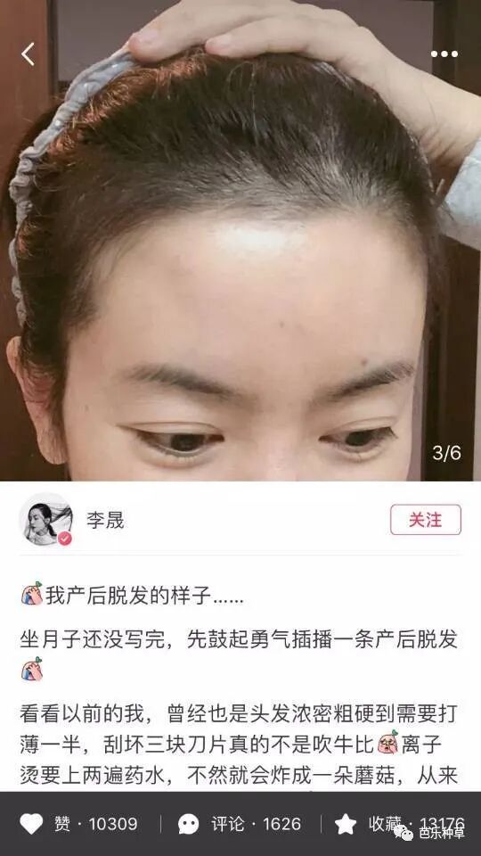 医用脱毛剂怎么用长生堂生发液超牛逼的生发水／脱毛症治疗剂，真的有效！没任何副作用如果你也有秃头，掉发，脱发严重，找它就行！3瓶一疗程，坚持使用！_https://www.jmylbn.com_新闻资讯_第6张