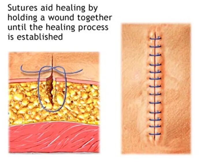 力學(xué)測試中的幾何美學(xué)