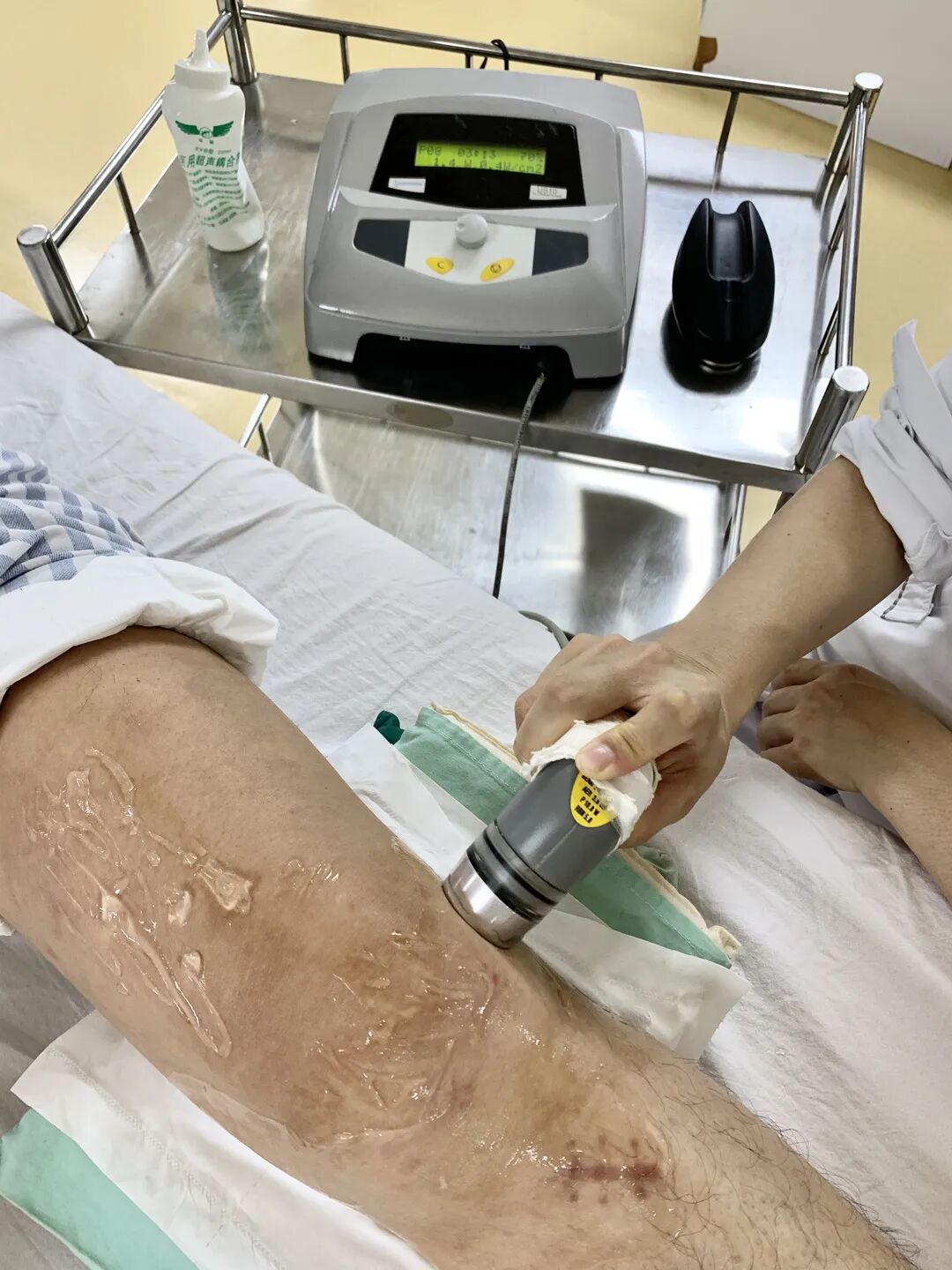 超声波治疗是什么什么是超声波治疗？_https://www.jmylbn.com_新闻资讯_第9张