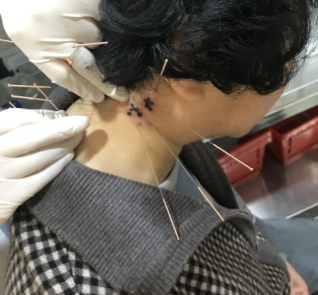 病床床档怎么写家庭病床知多少_https://www.jmylbn.com_新闻资讯_第10张