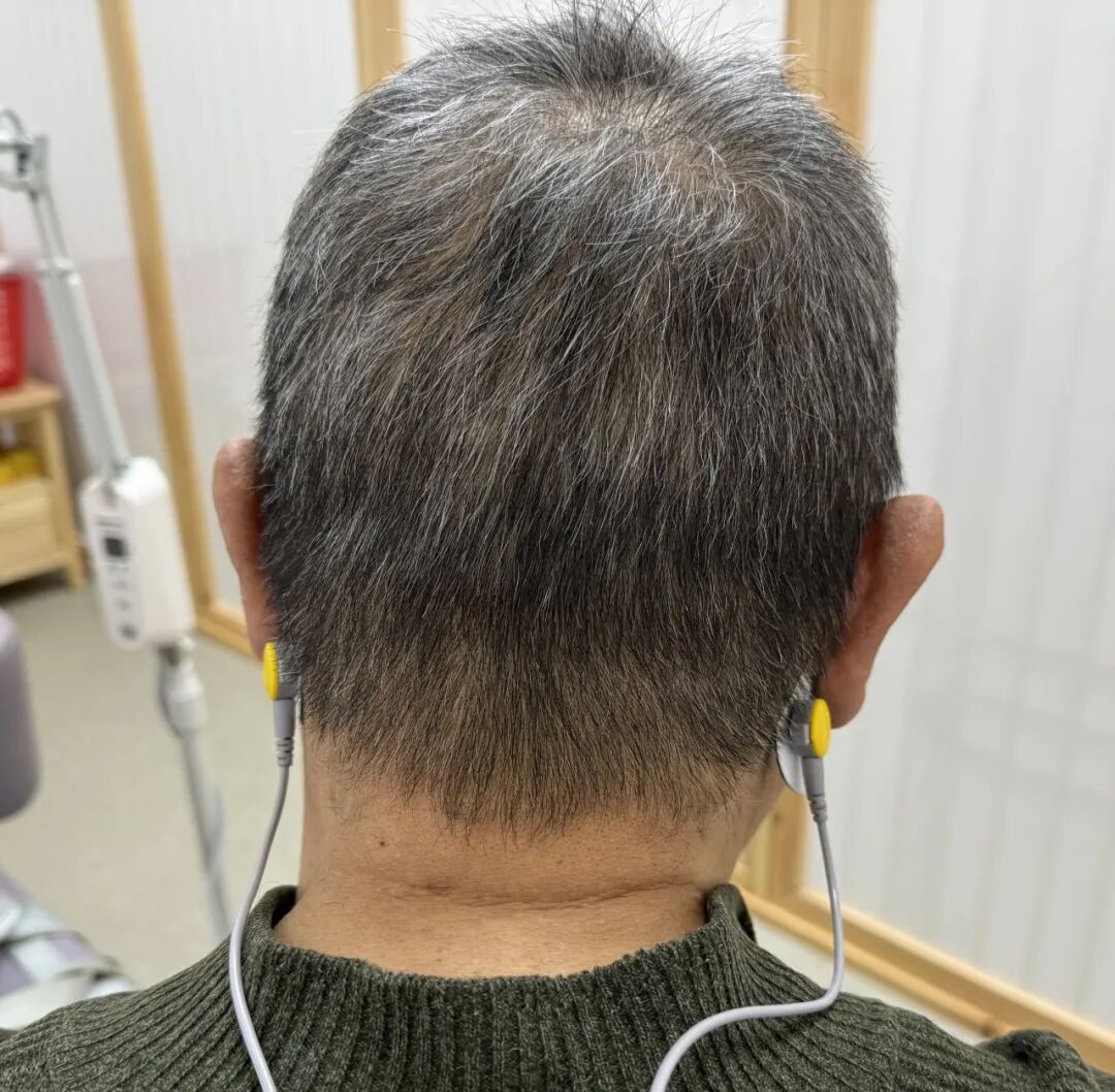 磁疗产品怎么试健康科普丨中风后如何快速恢复？脑循环治疗仪值得一试！_https://www.jmylbn.com_新闻资讯_第2张