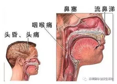 如果你有鼻炎，留下它！如果朋友有鼻炎，就转给他！