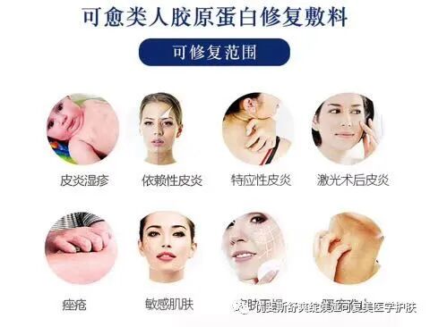 液体敷料喷雾怎么用三分做七分养，医美术后如何修复？   优斐斯喷雾 优斐斯液体敷料褪黑型传明酸 艺霏 可预 博乐达 拜瑞格 百植萃_https://www.jmylbn.com_新闻资讯_第12张