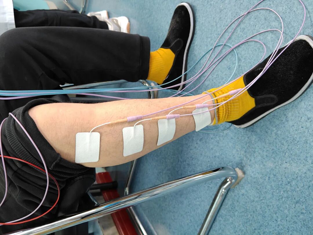 康复综合治疗仪怎么样【台医康复】神经肌肉电刺激治疗仪_https://www.jmylbn.com_新闻资讯_第2张