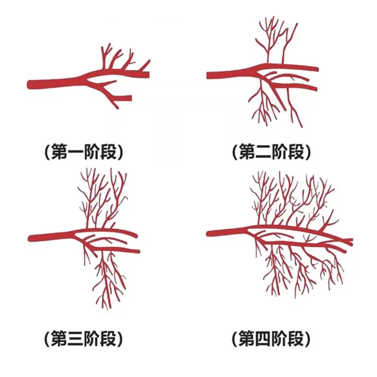 能量治疗器械有哪些勃起功能障碍先进治疗设备——以色列Renova体外线性冲击波治疗仪_https://www.jmylbn.com_新闻资讯_第4张