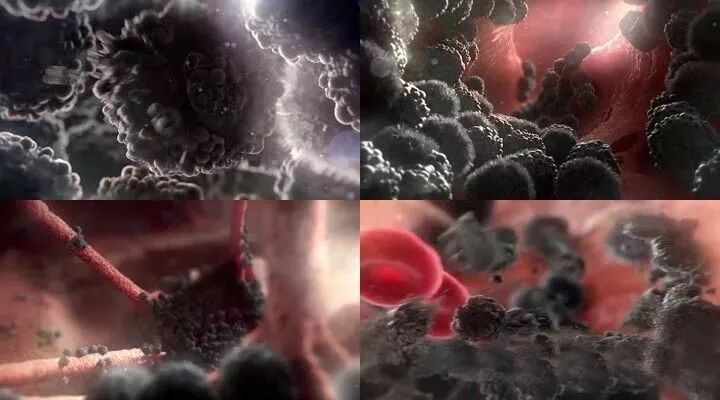 高压臭氧治疗什么高剂量高压臭氧自血疗法（HOT）“净化血液提高免疫”_https://www.jmylbn.com_新闻资讯_第2张