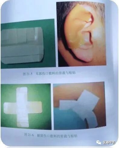 伤口贴敷料为什么伤口敷料的分类与选择技巧_https://www.jmylbn.com_新闻资讯_第26张