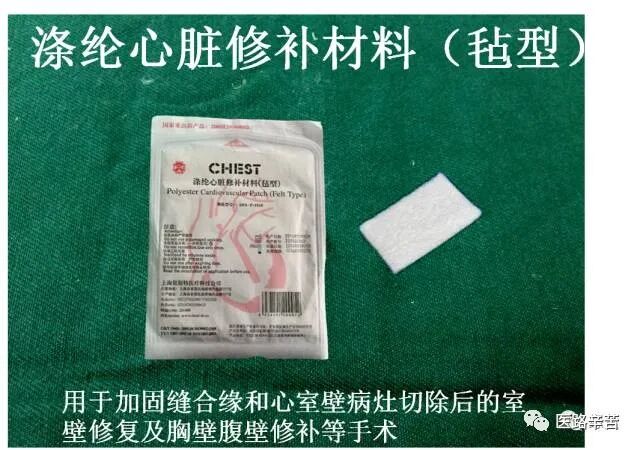 普外科耗材包括哪些手术耗材普及_https://www.jmylbn.com_新闻资讯_第75张