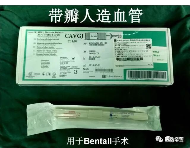 普外科耗材包括哪些手术耗材普及_https://www.jmylbn.com_新闻资讯_第119张