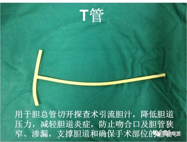 普外科耗材包括哪些手术耗材普及_https://www.jmylbn.com_新闻资讯_第35张