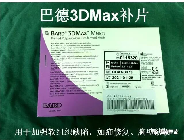 普外科耗材包括哪些手术耗材普及_https://www.jmylbn.com_新闻资讯_第71张