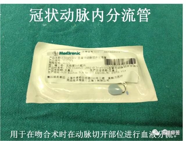 普外科耗材包括哪些手术耗材普及_https://www.jmylbn.com_新闻资讯_第115张