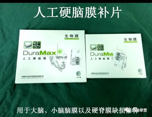 普外科耗材包括哪些手术耗材普及_https://www.jmylbn.com_新闻资讯_第74张