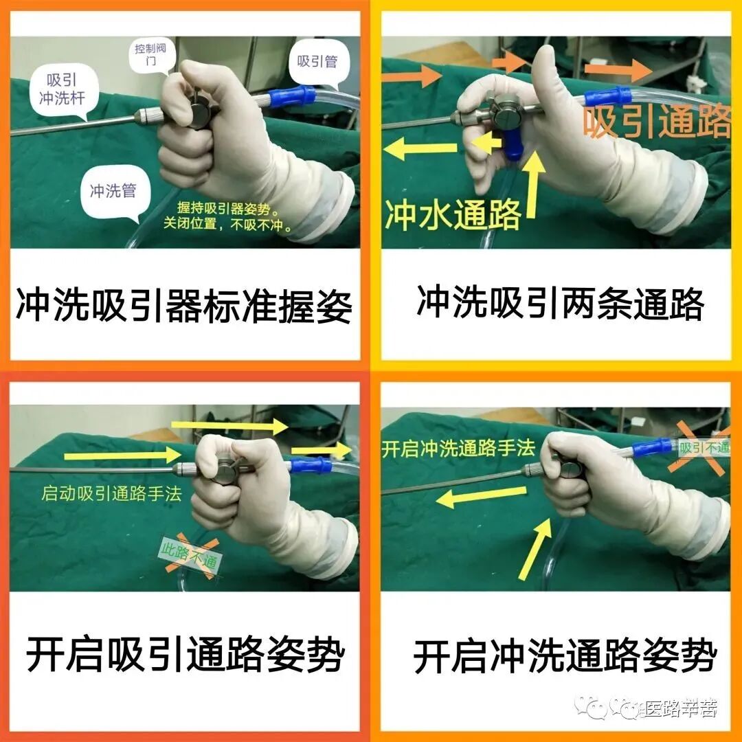 手术吸引器怎么使用腹腔镜器械 ｜ 吸引器的“妙用”_https://www.jmylbn.com_新闻资讯_第1张
