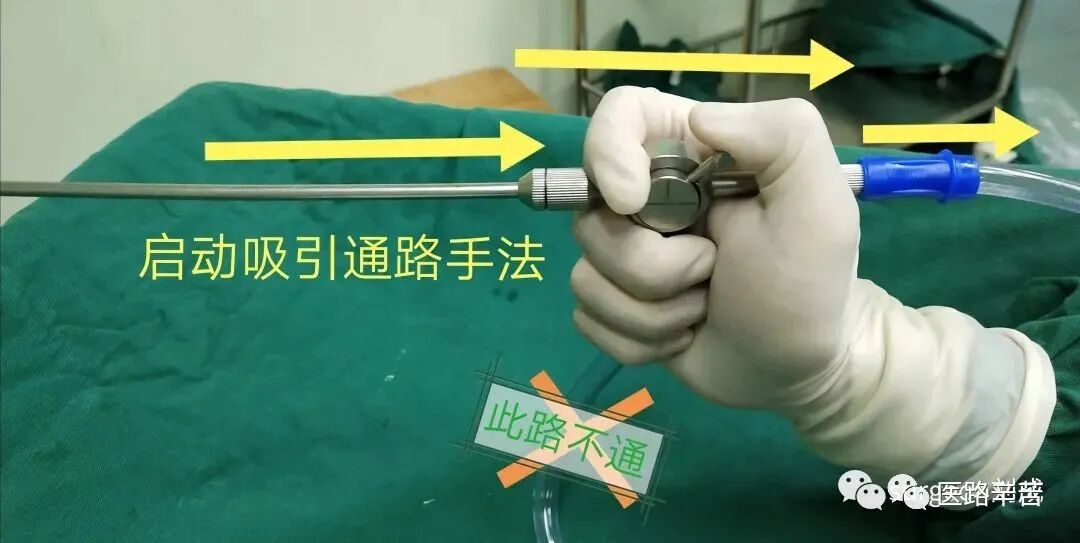 手术吸引器怎么使用腹腔镜器械 ｜ 吸引器的“妙用”_https://www.jmylbn.com_新闻资讯_第3张