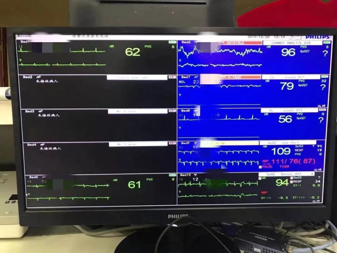 心脏监护仪怎么看关于监护仪的4个常见疑问！_https://www.jmylbn.com_新闻资讯_第4张