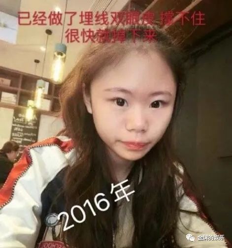 娜娜整容图片