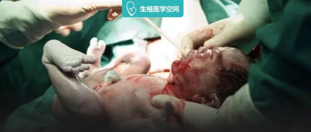 100张高清照片，带你围观最真实的剖腹产手术！（临产孕妇禁入）